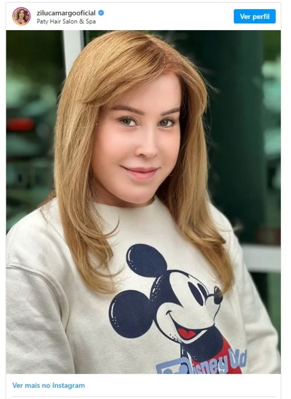 image-80 Zilu exagera em procedimento para ficar jovem e fãs reagem de forma negativa: ‘como tem coragem?’