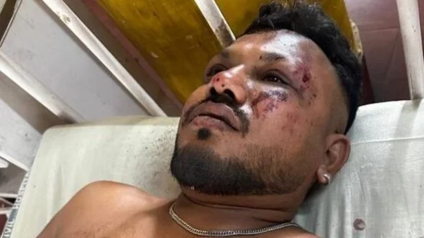 image-97 Novo vídeo mostra único sobrevivente do voo da Air India deixando destroços da aeronave