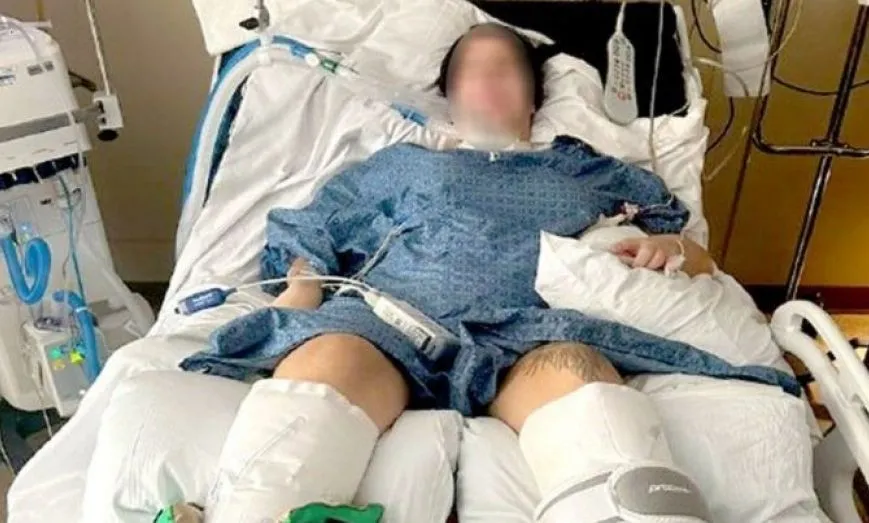 image-105 “FOI SÓ UMA COLHER”: BRASILEIRA DE 23 ANOS FICA TETRAPLÉGICA APÓS TOMAR SOPA ENLATADA NOS EUA